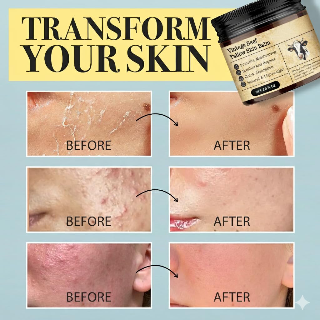 Beef Tallow Honey Balm for Sensitive Skin (DS)
