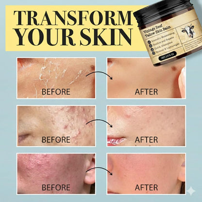 Beef Tallow Honey Balm for Sensitive Skin (DS)