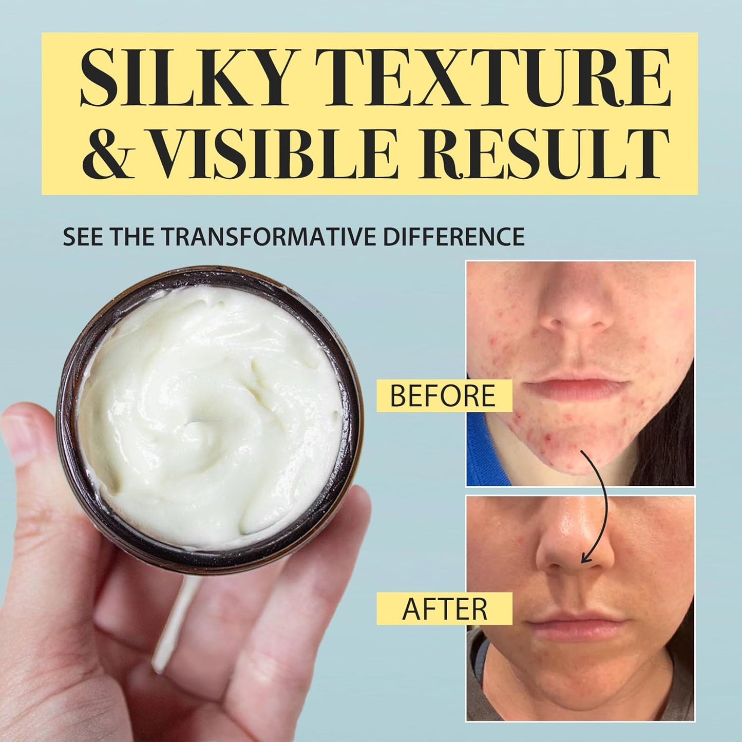 Beef Tallow Honey Balm for Sensitive Skin (DS)