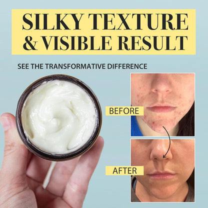 Beef Tallow Honey Balm for Sensitive Skin (DS)